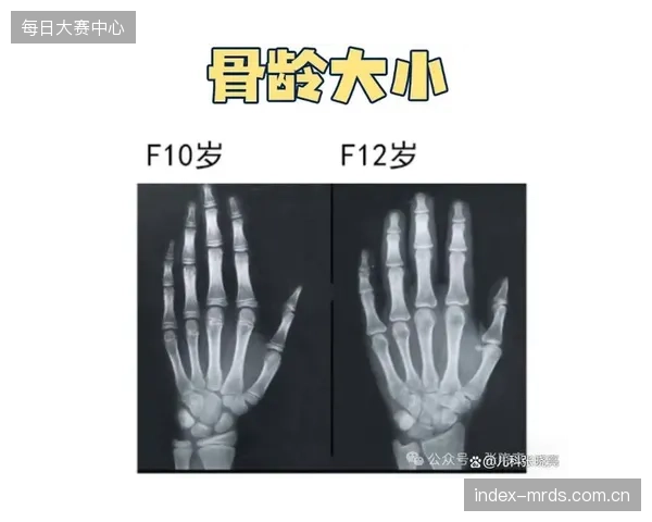 职业足球俱乐部开始将球员的骨龄发育数据视为核心资产进行长期管理与深度挖掘